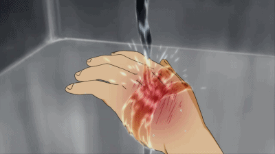 다친손을 물에 씻는 장면